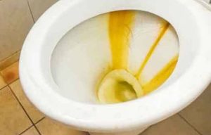 yellow stains in a toilet bowl